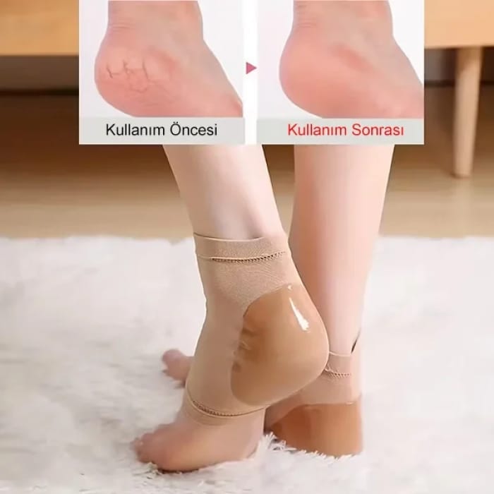 Çatlamış Topuklara Son: İpek Yumuşaklığı